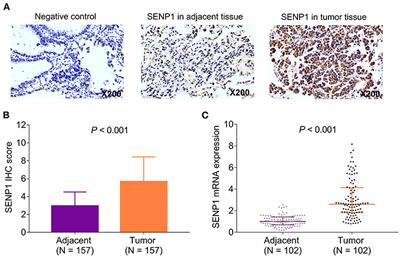 SENP1 Aberrance and Its Linkage to Clinical Features, Adjuvant Regimen, and Prognosis in Patients With Surgical Non-small Cell Lung Cancer Receiving Adjuvant Chemotherapy